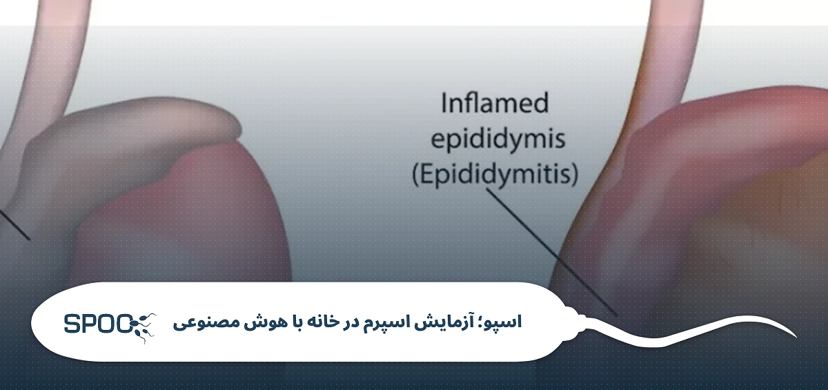 عدم تقارن بیضه‌ها | آیا بالا و پایین بودن بیضه خطرناک است؟