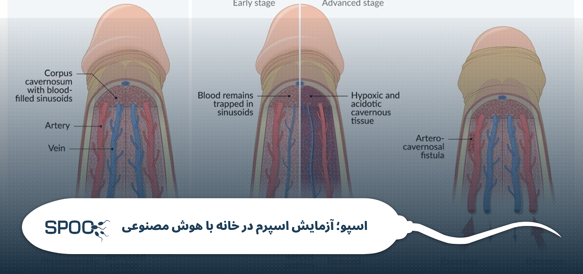 مکانیسم فیزیولوژیک نعوظ و پریاپیسم