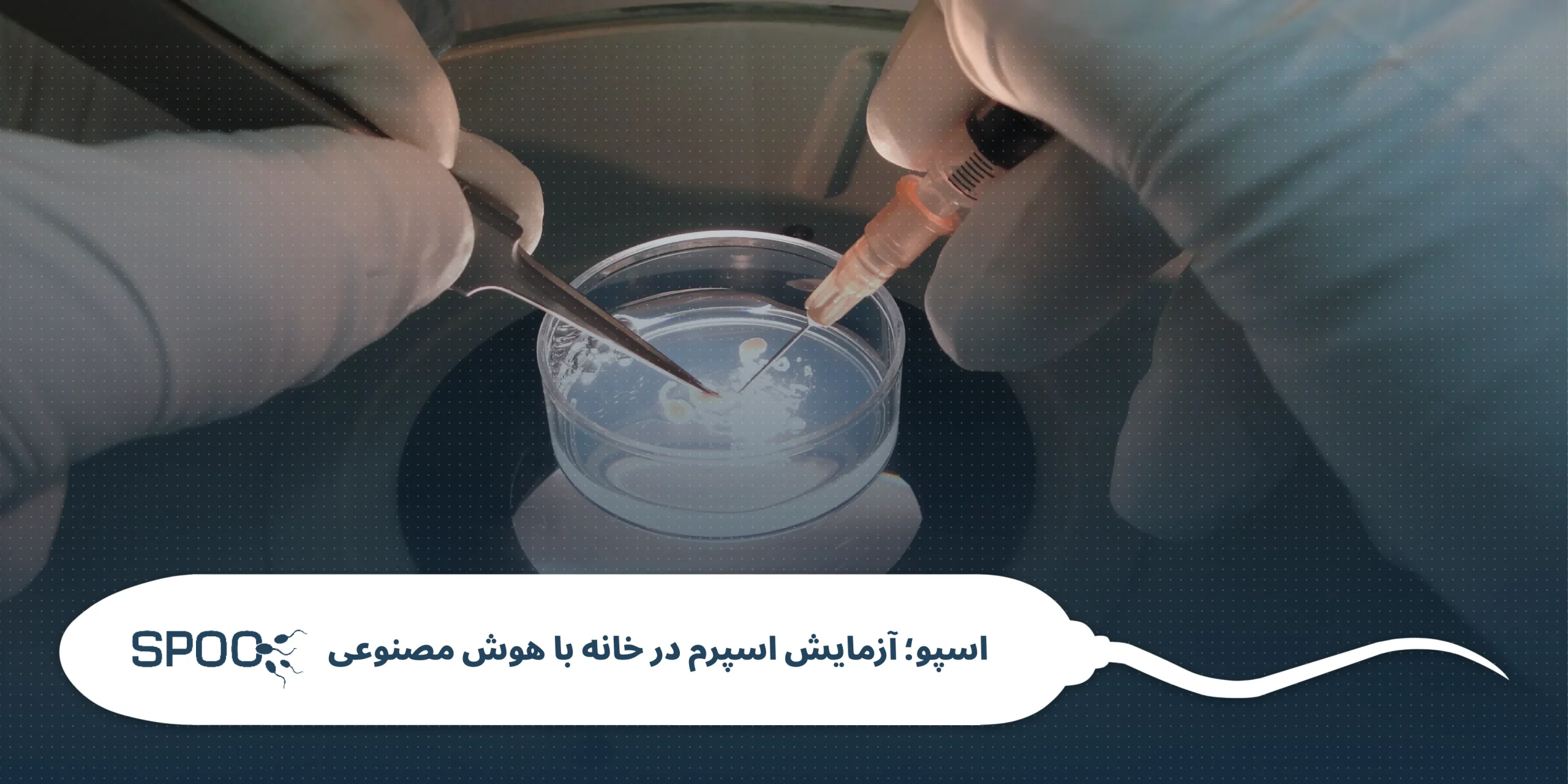کیفیت اسپرم یا تعداد اسپرم؟ کدامیک مهم است؟