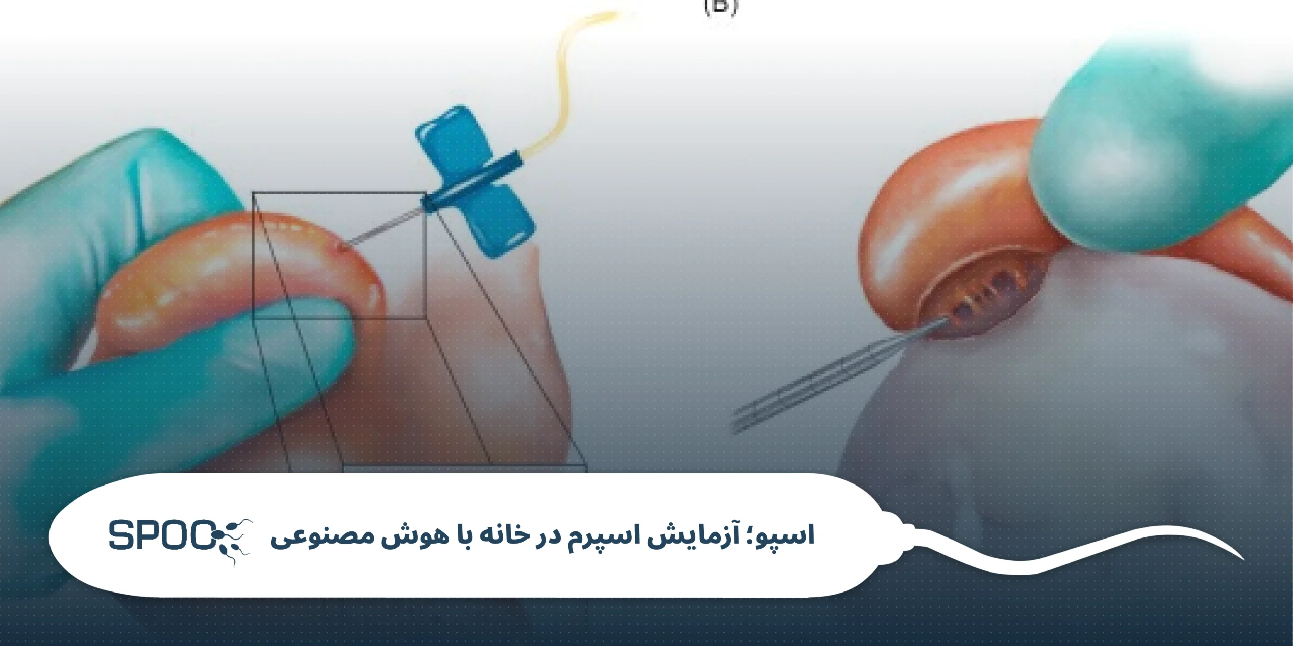 انسداد لوله منی