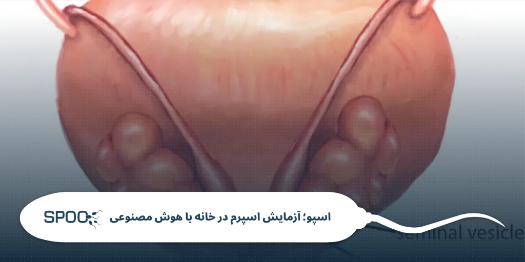 انسداد لوله منی: علل، علائم و روش‌های درمان
