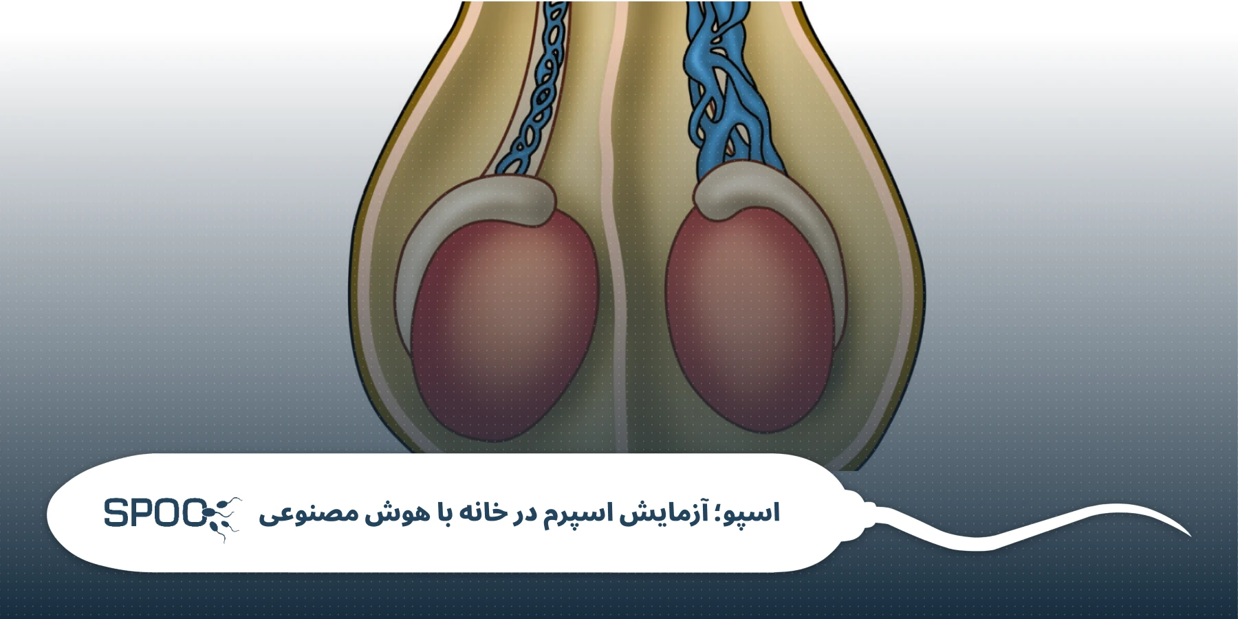 درجهبندی واریکوسل و تفاوت گریدها