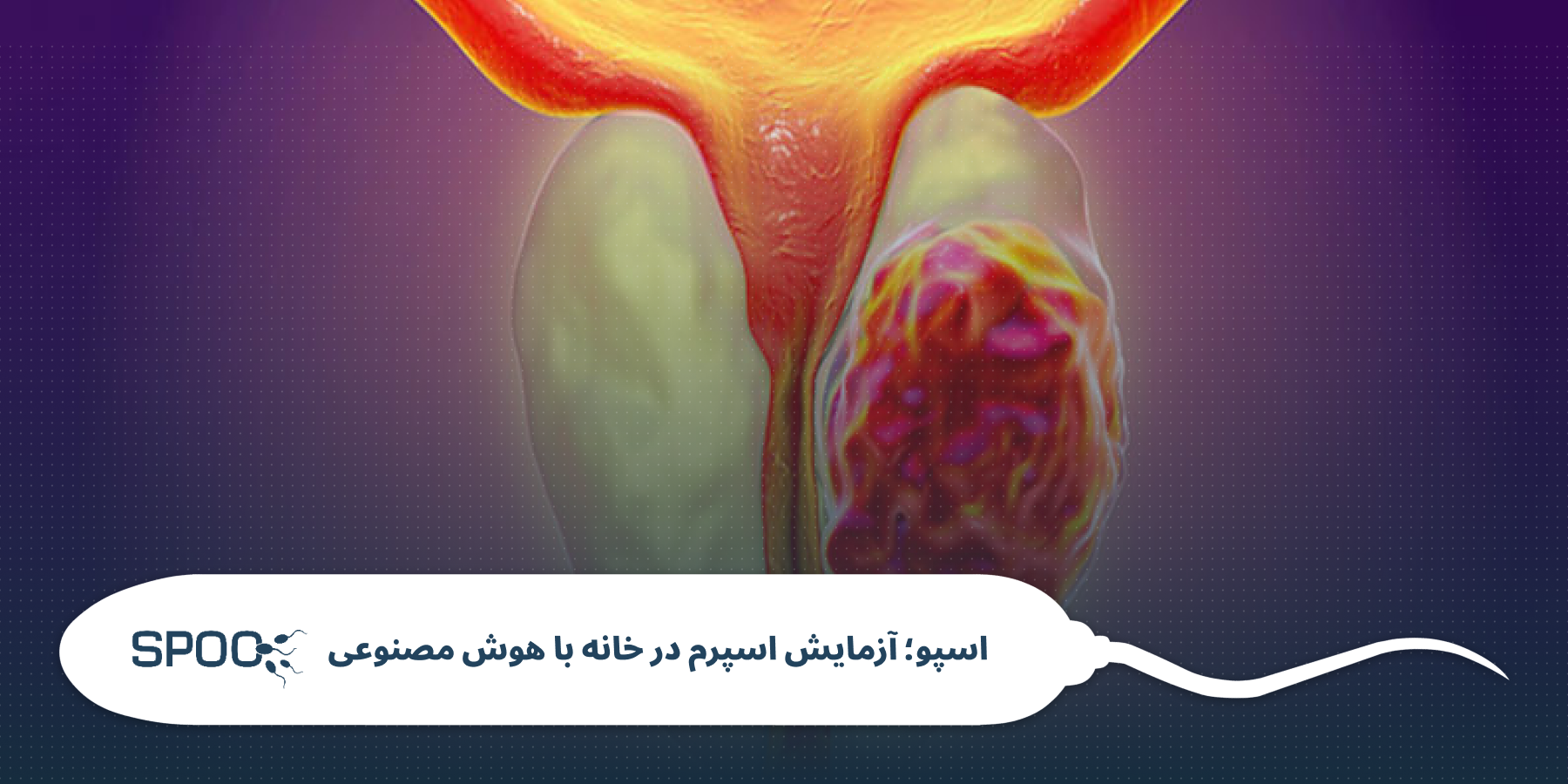 عوامل مؤثر بر سلامت پروستات