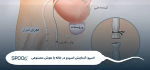 وازکتومی چیست و آیا بعد از آن امکان بچه‌دار شدن هست؟