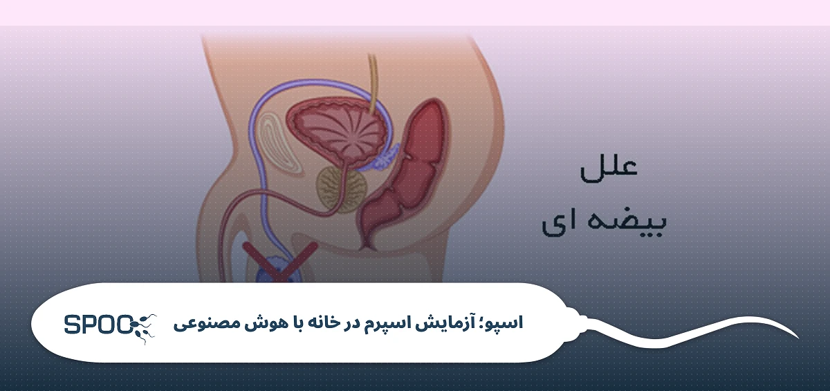 آزمایش‌های تکمیلی در صورت نیاز