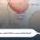 وازکتومی چیست و آیا بعد از آن امکان بچه‌دار شدن هست؟