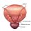 posterior_bladder